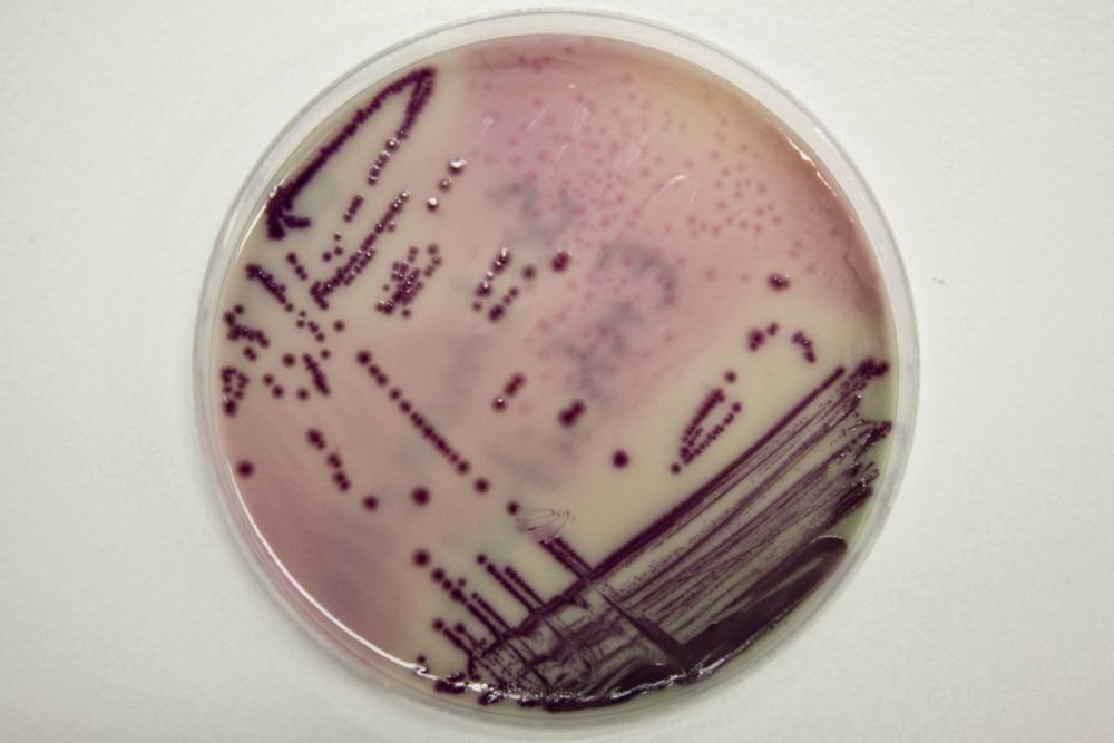 salmonella na skorupkach jaj, Fermy Drobiu Woźniak, jaja zdrovo Rodzinkovo, Salmonella enteritidis